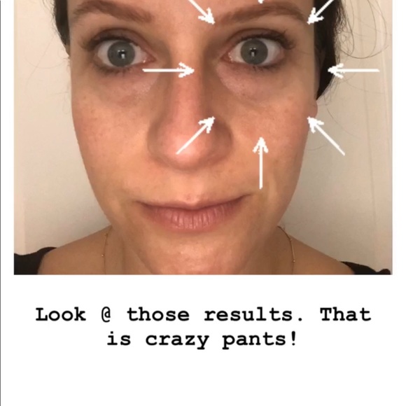monat eye smooth results
